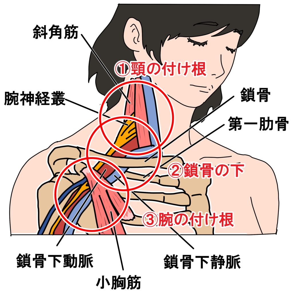 胸郭出口症候群 茂澤メディカルクリニック 公式 南千住駅3分 内科 皮膚科 リハビリテーション科 整形外科